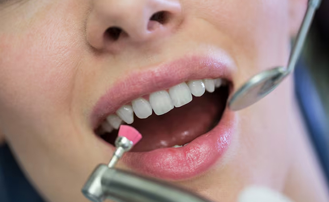 Dental consultation